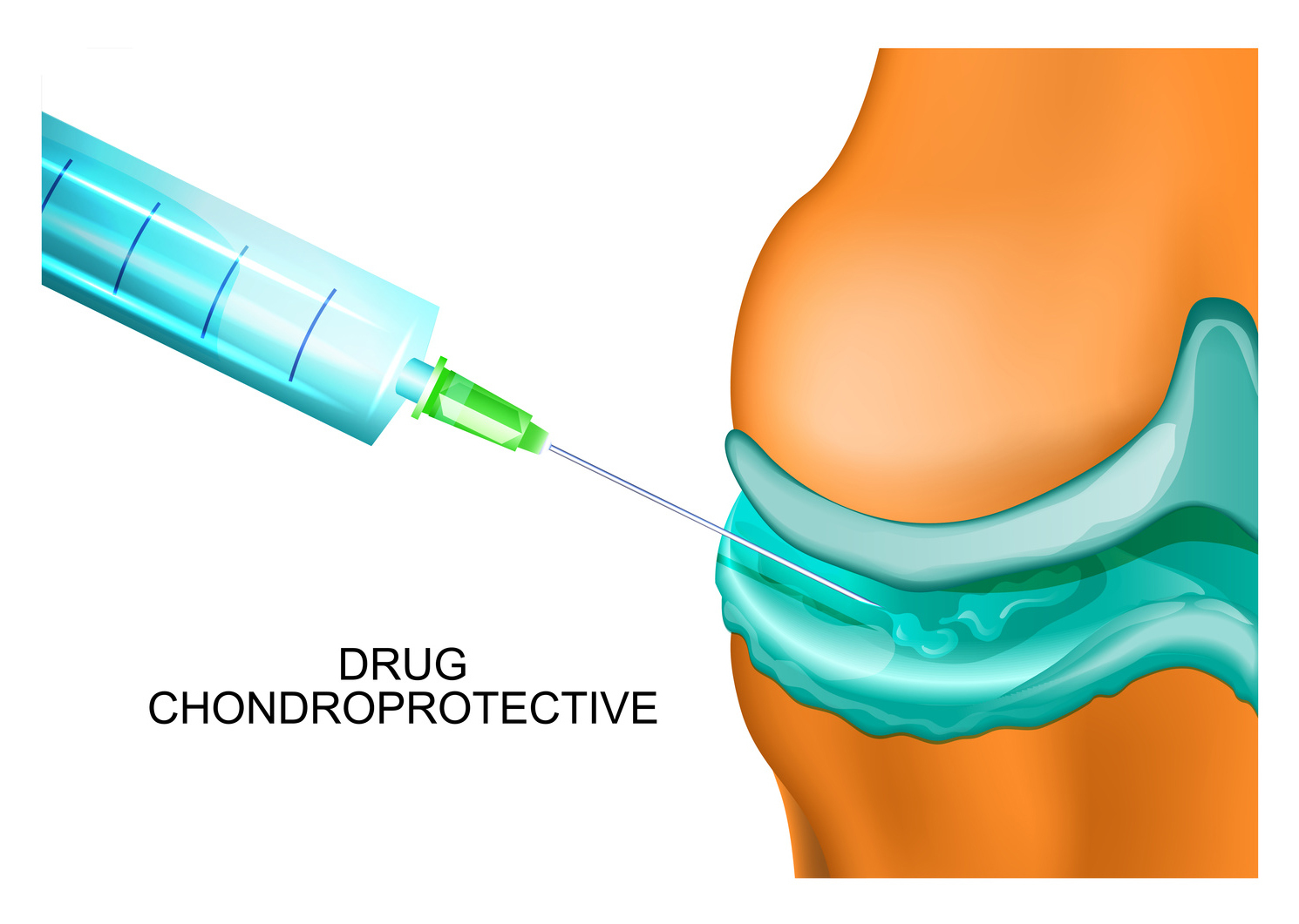 Chondroprotective Drugs