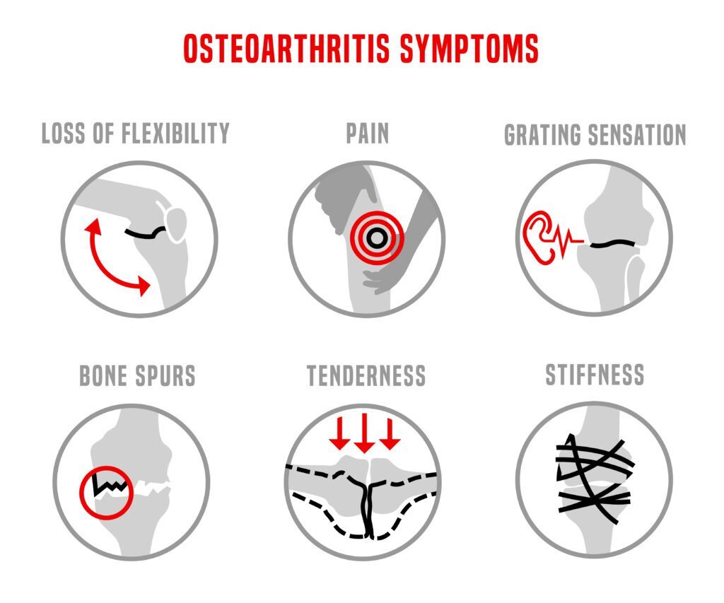 Osteoarthritis Symptoms